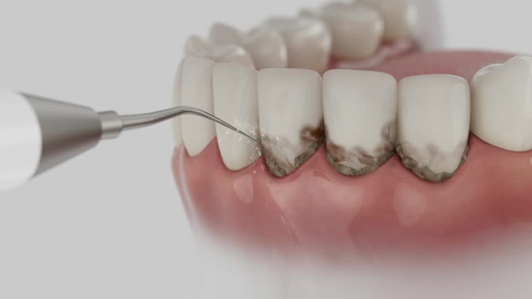 Reliable Dental Implants contractor in Laureldale, PA by Smile Center Dentistry
